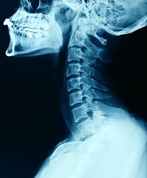 The Benefits of an On-Site X-Ray at the Chiropractor